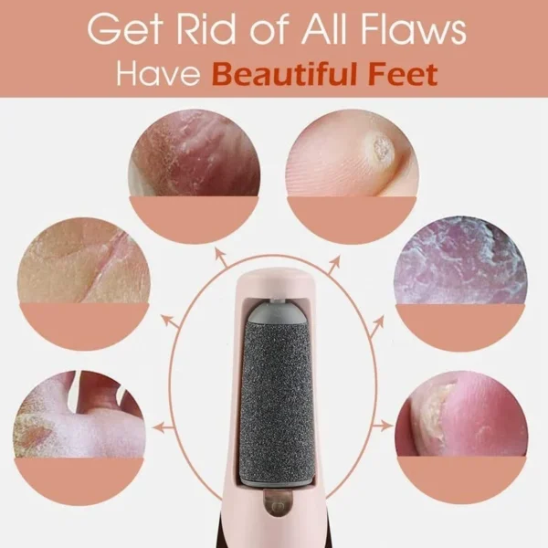 Electric Leg Skin Remover - vestidoco.com - Image 3