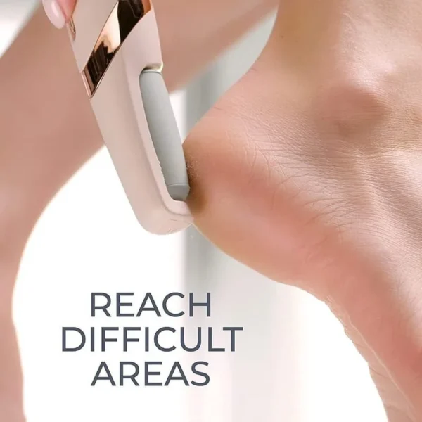 Electric Leg Skin Remover - vestidoco.com - Image 2